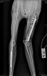 Misha X-Ray